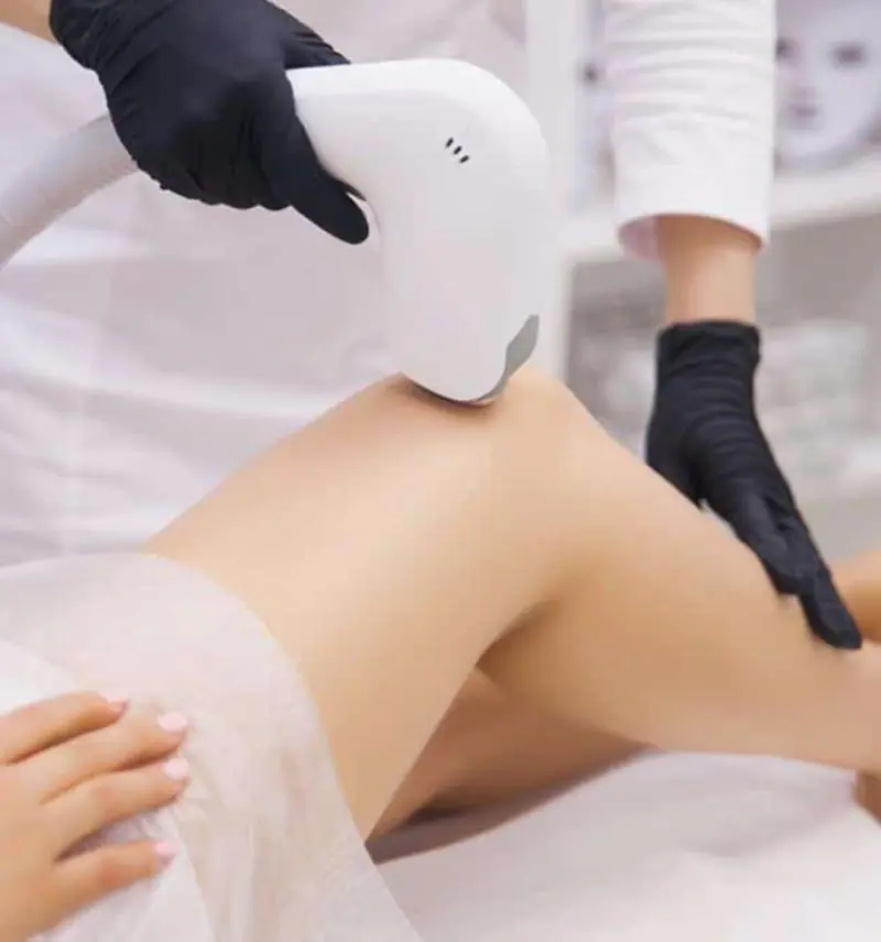 Laser Hair Removal Treatment